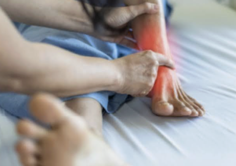 sciatic nerve vitamin deficiency